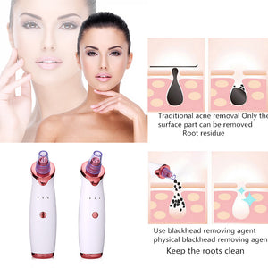 Skiny Boo® Blackhead, Black Dot, Acne, Black Head Pore Removing & Face Cleaning Vacuum Beauty Skin Care Tool