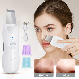 Skiny Boo® Ultrasonic Skin Scrubber For Deep Pore Cleaning